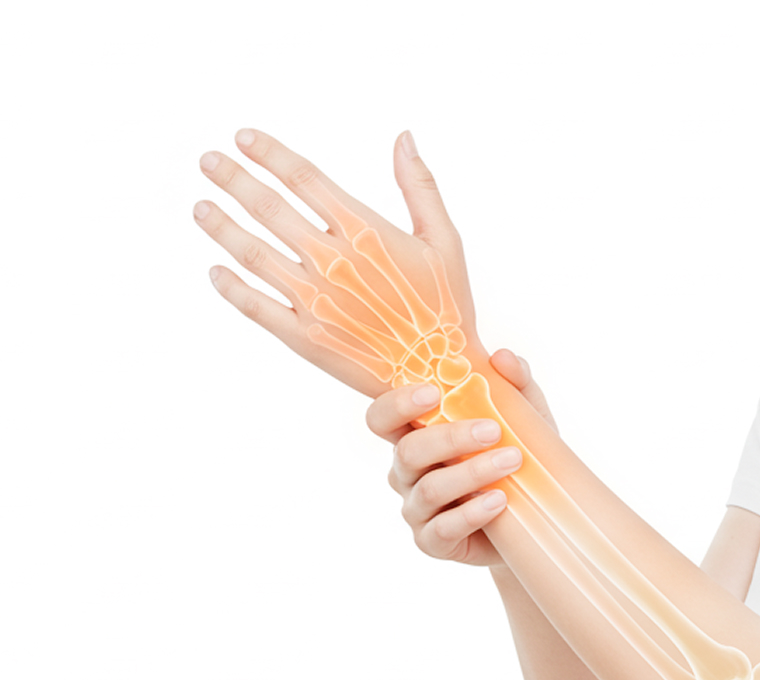 손목터널증후군